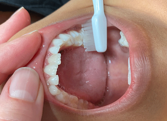 Tandbørstning på barn